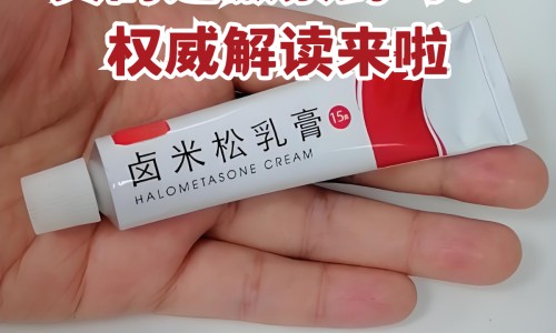 ct与x线的区别专家终于讲清楚了-x线跟ct区别网- x线和ct哪个更清晰知识,分享X线和CT哪个更准